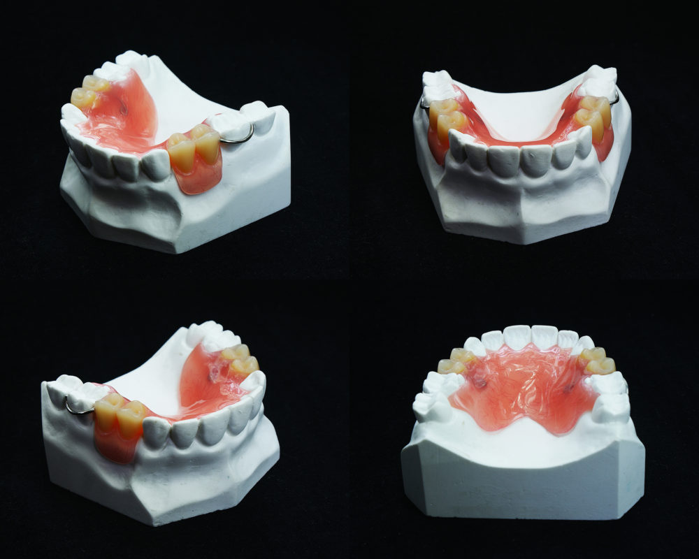 Prosthodontics GlobeHealer