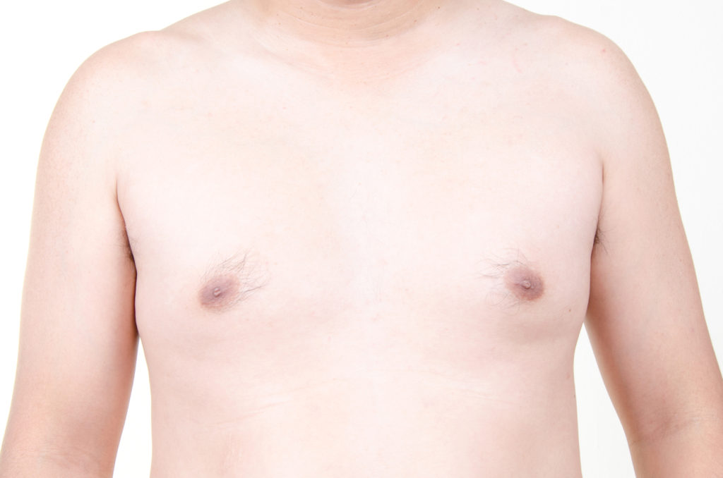 surgical-treatment-for-gynecomastia-globehealer